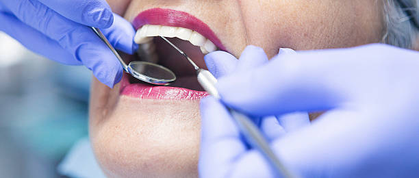 Best Chipped Tooth Repair Near Me  in Shepherd, TX